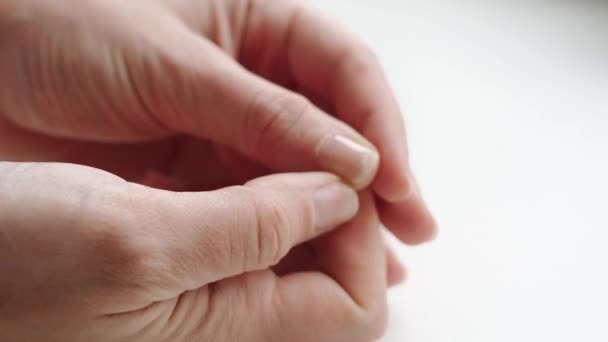 Zbliżenie łamliwych paznokci na kobiecej dłoni. Białe tło. Złamany i suchy paznokieć. Awitaminoza i niedobory mikroelementów — Wideo stockowe