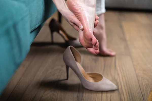 Feche de pés de mulher com calo. Mau problema de saúde dos sapatos errados. Dor nos pés — Fotografia de Stock