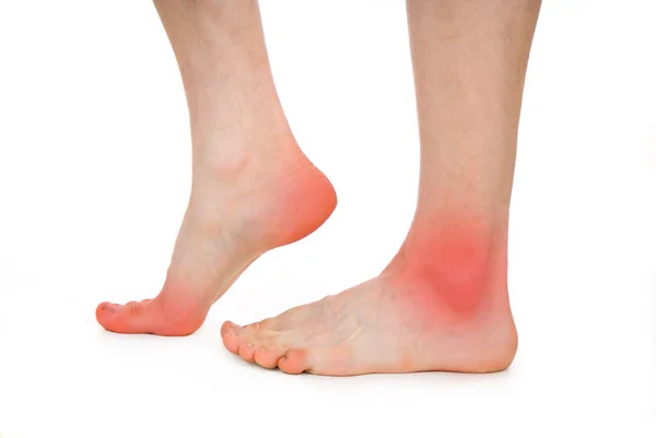 Männlicher Fuß, Ferse, Füße — Stockfoto