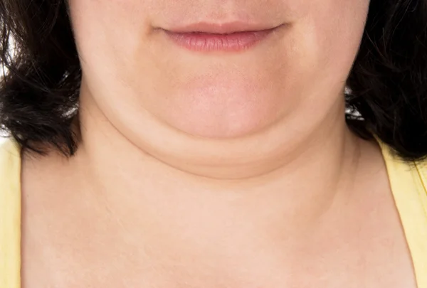 Girl shows off his big chin — Stock Photo, Image