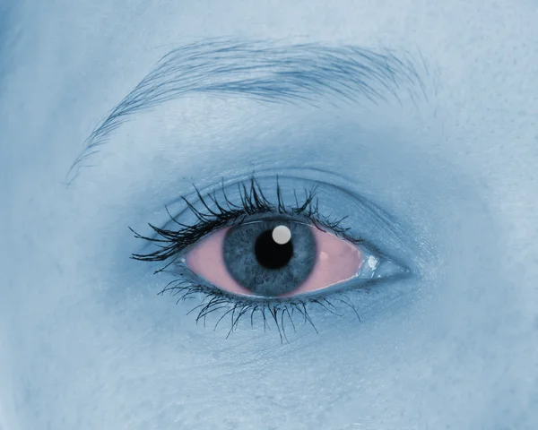Болючі очі, показані червоні — стокове фото