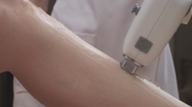 Lazer tüy temizleme makinesi uzmanlar tarafından kullanılırken bacak lazer epilasyon prosedürünün kapatılması