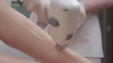 Close-up of leg laser epilation procedure while laser hair removal machine is used by specialist