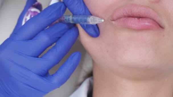 Closeup Botox Lip Injection Using Syringe Nurse Wearing Blue Gloves — Vídeo de stock
