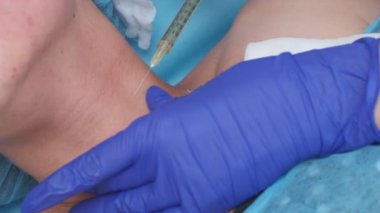 Closeup of cosmetic botox injection in the neck by nurse wearing blue gloves
