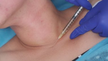 Closeup of cosmetic botox injection in the neck by nurse wearing blue gloves