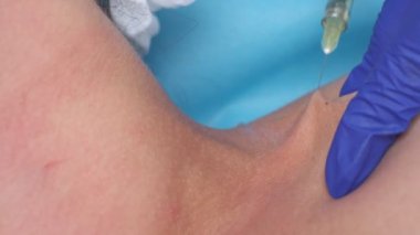 Closeup of cosmetic botox injection in the neck by nurse wearing blue gloves