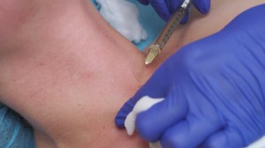 Closeup of cosmetic botox injection in the neck by nurse wearing blue gloves