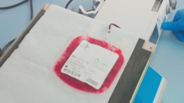 Blood sample for covid vaccine is shaked in laboratory, slow motion