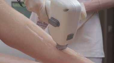 Close-up of leg laser epilation procedure while laser hair removal machine is used by specialist