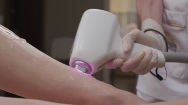 Lazer tüy temizleme makinesi uzmanlar tarafından kullanılırken bacak lazer epilasyon prosedürünün kapatılması