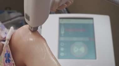 Lazer tüy temizleme makinesi uzmanlar tarafından kullanılırken bacak lazer epilasyon prosedürünün kapatılması