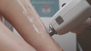 Lazer tüy temizleme makinesi uzmanlar tarafından kullanılırken bacak lazer epilasyon prosedürünün kapatılması