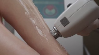 Lazer tüy temizleme makinesi uzmanlar tarafından kullanılırken bacak lazer epilasyon prosedürünün kapatılması