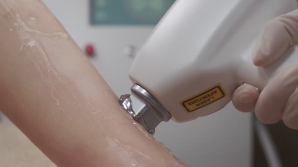 Close Leg Laser Epilation Procedure While Laser Hair Removal Machine — Stock Video