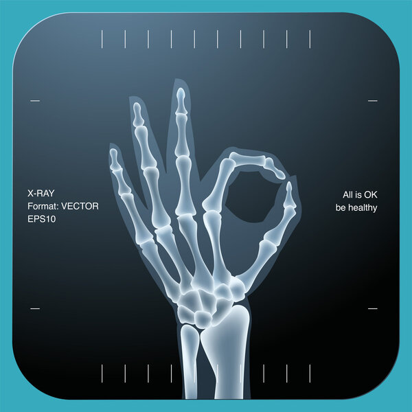 X-ray of both human hand