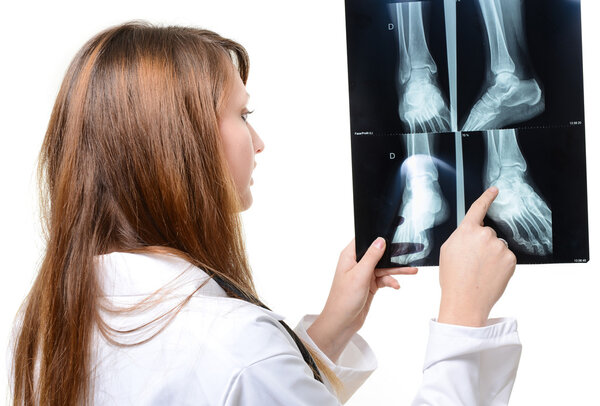 Female doctor looking at X-ray image