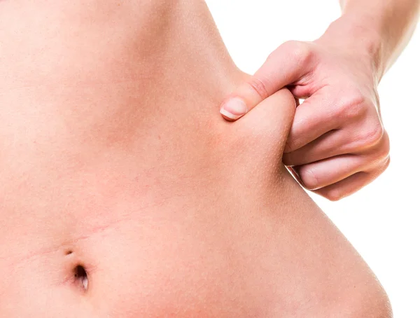 Close-up female pinching skin of her hip — Stock Photo, Image