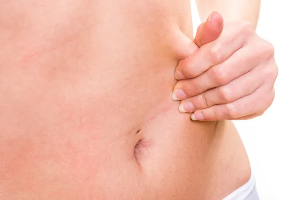 Close up female pinching skin of her belly — Stock Photo, Image