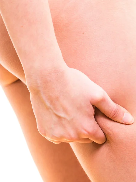 Kvinna kontrollerar celluliter på hennes ben — Stockfoto