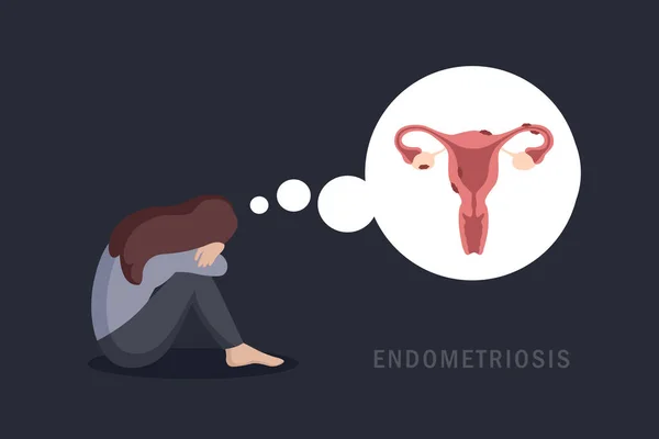 Endometriose Und Normaler Uterus Frauen Gesundheit Anatomie Info Grafik Vektorillustration — Stockvektor