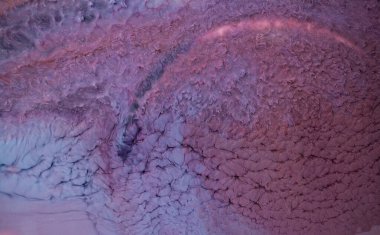 Alkol mürekkebi. Pembe ve mor renkte modern bir resim tekniği. Sanatsal tasarım. Bu sihirli sanatı yaratmak için resimler, ek olarak gümüş parıltılar, çizgiler. Sanat tasarımının başyapıtı.