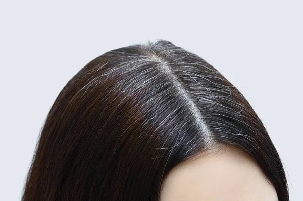 Kafkasyalı bir kadının tacındaki gri saçlar..