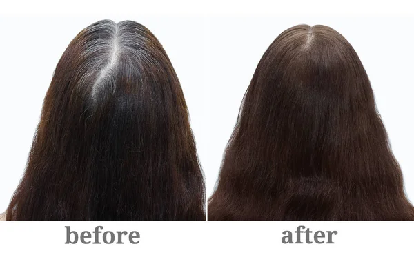 Γκρι Μαλλιά Στο Στέμμα Του Κεφαλιού Μιας Γυναίκας Χρωματισμός Μαλλιών — Φωτογραφία Αρχείου