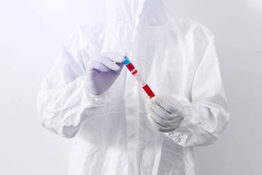 Coronavirus kan testi, test tüpü tutan doktor tıbbi teknoloji konsepti.
