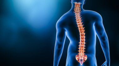 Omurga ve insan vücudunun eğriliği. 3D görüntüleme, fotokopi alanı ile gösteriliyor. Omurga bozukluğu veya deformasyon, omurga hasarı, insan anatomisi ve tıbbi kavramlar.