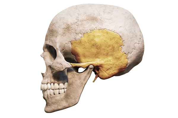 Anatomisch Nauwkeurige Menselijke Schedel Met Ingekleurde Temporale Bot Laterale Profielweergave — Stockfoto