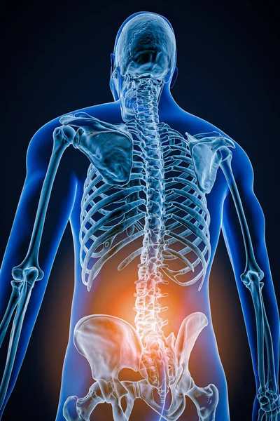 Posterior or back view of human spine or spinal column with inflammation or injury 3D rendering illustration. Pathology, backbone pain, anatomy, lumbar hernia, medical and healthcare concept.