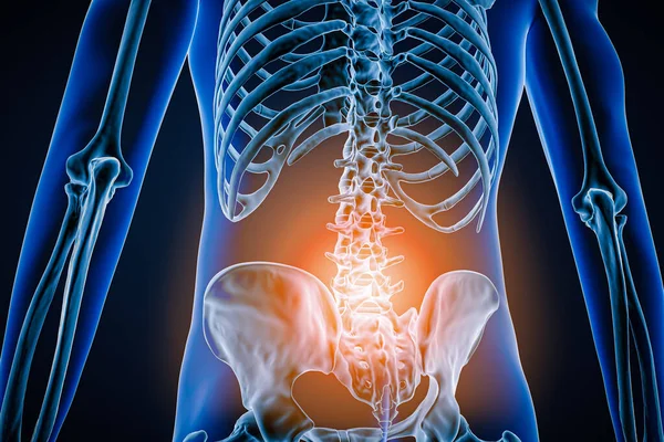 Posterior or back view of human spine or spinal column with inflammation or injury 3D rendering illustration. Pathology, backbone pain, anatomy, lumbar hernia, medical and healthcare concept.