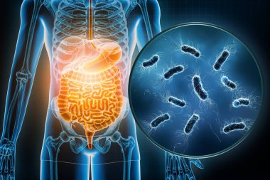 Gastrointestinal bölgede bakteriyel enfeksiyon var. Escherichia Coli veya E. Coli bulaşıcı hastalıklar, anatomi, tıp, biyoloji, bilim, sağlık konseptleri.