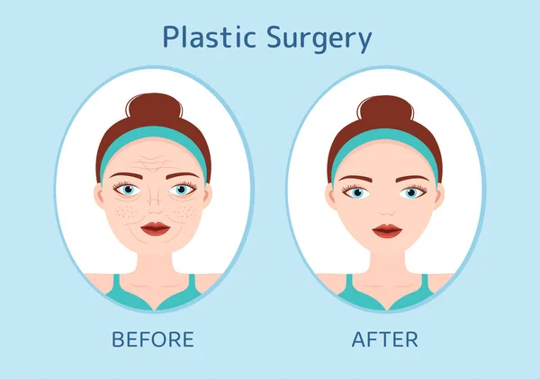プラスチック外科フラット漫画ハンドドローテンプレート高度な機器を使用して期待通りに体や顔に医療外科手術のイラスト — ストックベクタ