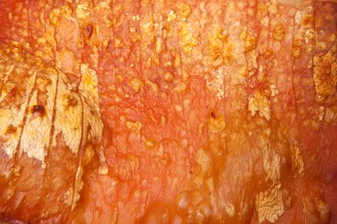 pişmiş göbek domuz