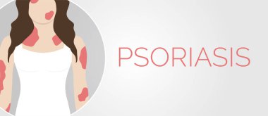 Sedef Hastalığı Cilt Hastalığı Arkaplan Çizimi Tasarımı