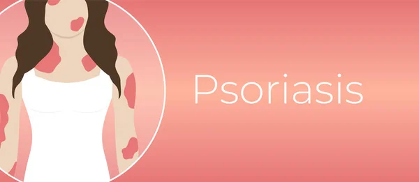 Psoriasis Enfermedad Fondo Ilustración Con Mujer Con Piel Roja — Vector de stock