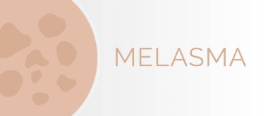 Melasma Cilt Durumu İllüstrasyon Vektörü Arkaplanı 