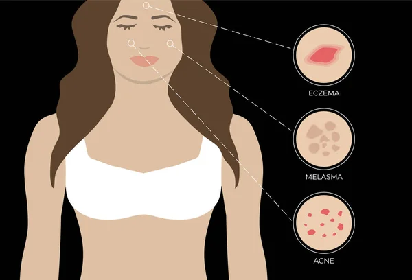 Ilustração Eczema Acne Melasma Com Mulher Fundo Preto — Vetor de Stock