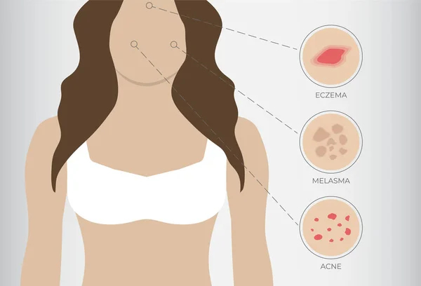 Ilustração Eczema Acne Melasma Com Fundo Mulher —  Vetores de Stock