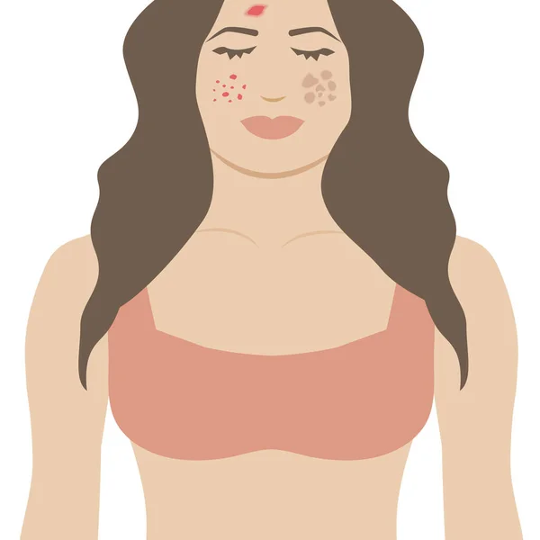 Isolated Girl Skin Issues Woman Eczema Acne Melasma Skin Problems — Stock Vector