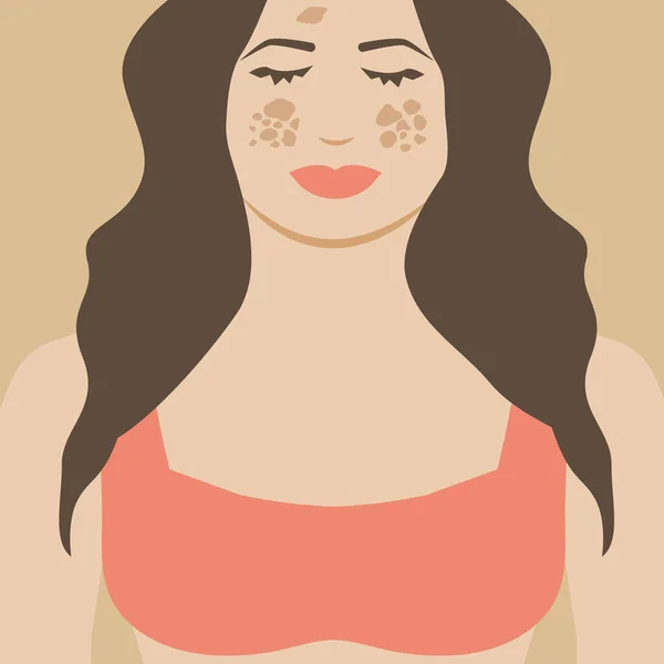 Chica Mujer Con Melasma Diseño Ilustración Manchas Pigmentación — Vector de stock