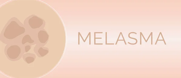 Melasma Skin Condition Illustration Design — Stock Vector