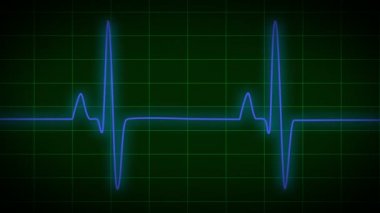 ekg kalp monitör