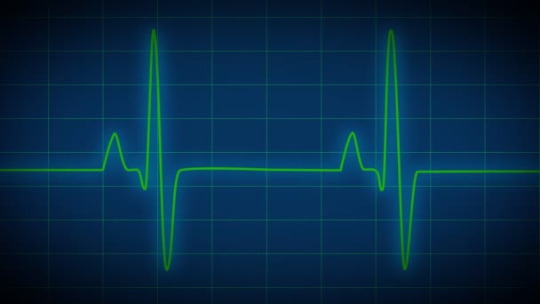 Monitor cardíaco ECG — Vídeo de Stock