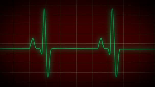 Heart Monitor EKG — Stock Video