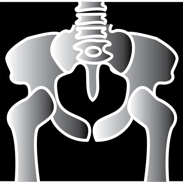 Xray van een bekken clipart illustratie — Stockvector