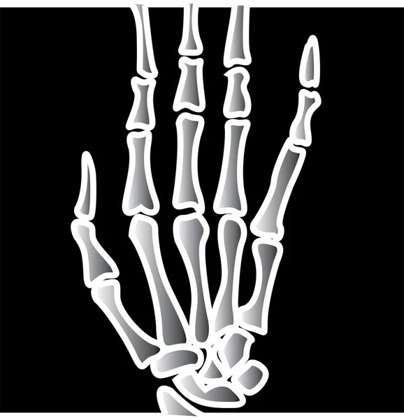 Xray Of Fingers On A — стоковый вектор