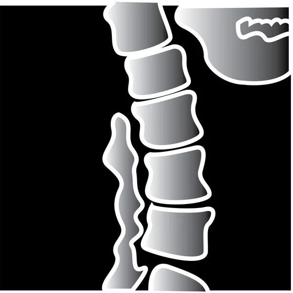 Raios-X de uma coluna vertebral — Vetor de Stock